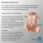 Causes and symptoms of umbilical hernia in babies