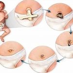 How to heal the baby's navel after birth