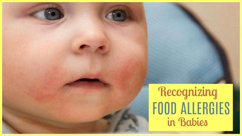 Food allergies and intolerances in babies