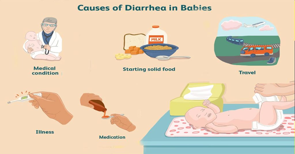 What is considered diarrhea in babies