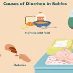 What is considered diarrhea in babies